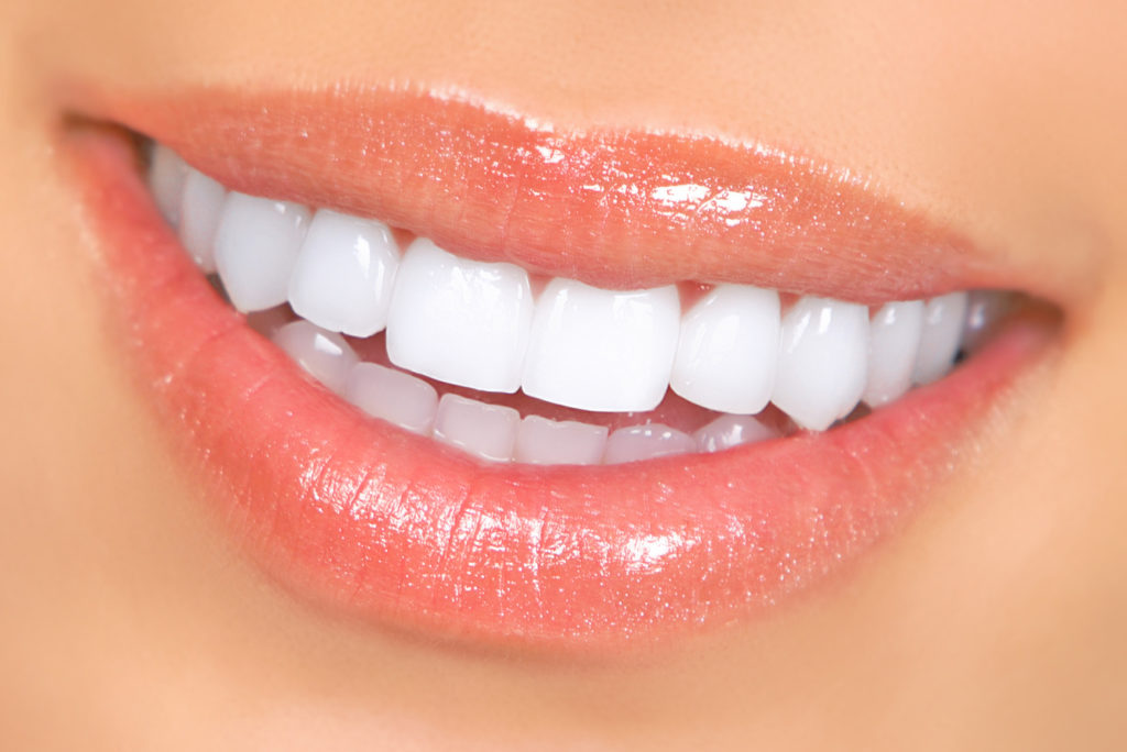 Teeth Whitening Dentist near Memorial City and Gessner in Houston